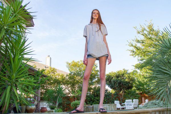 Woman With ‘Longest Legs in the World’ Makes Bank on OnlyFans