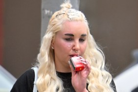 Amanda Bynes Before & After: What Happened to Her Face?