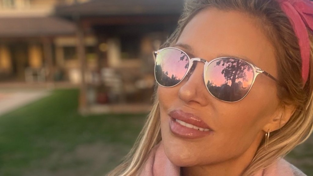 Brandi Glanville Reveals Chemical Burn As Nair Experiment Goes Wrong