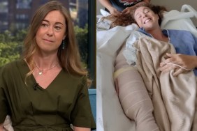 Woman Shows Arm Shark Attack Missing Hawaiit