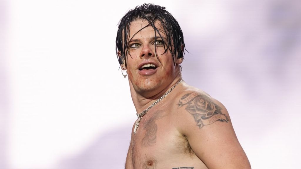 Yungblud Gives Tour Update After Dirt Bike Injury