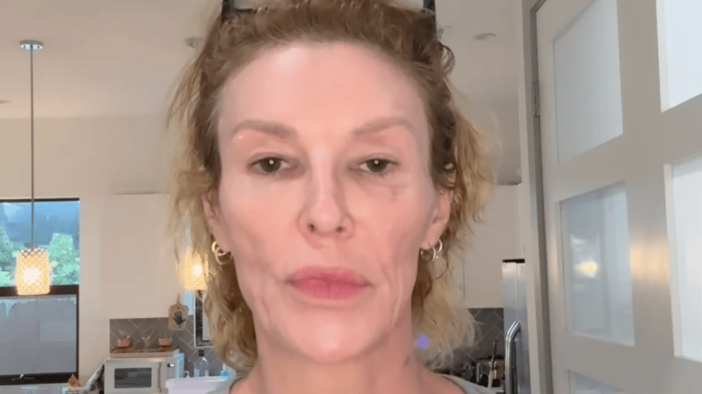 Brandi Glanville’s Friend Begs Public for Cash Amid Medical Nightmare