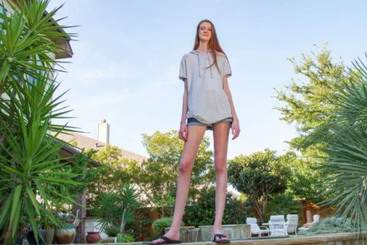 OnlyFans All-Stars: Woman With ‘Longest Legs in the World’ Reaches New Heights