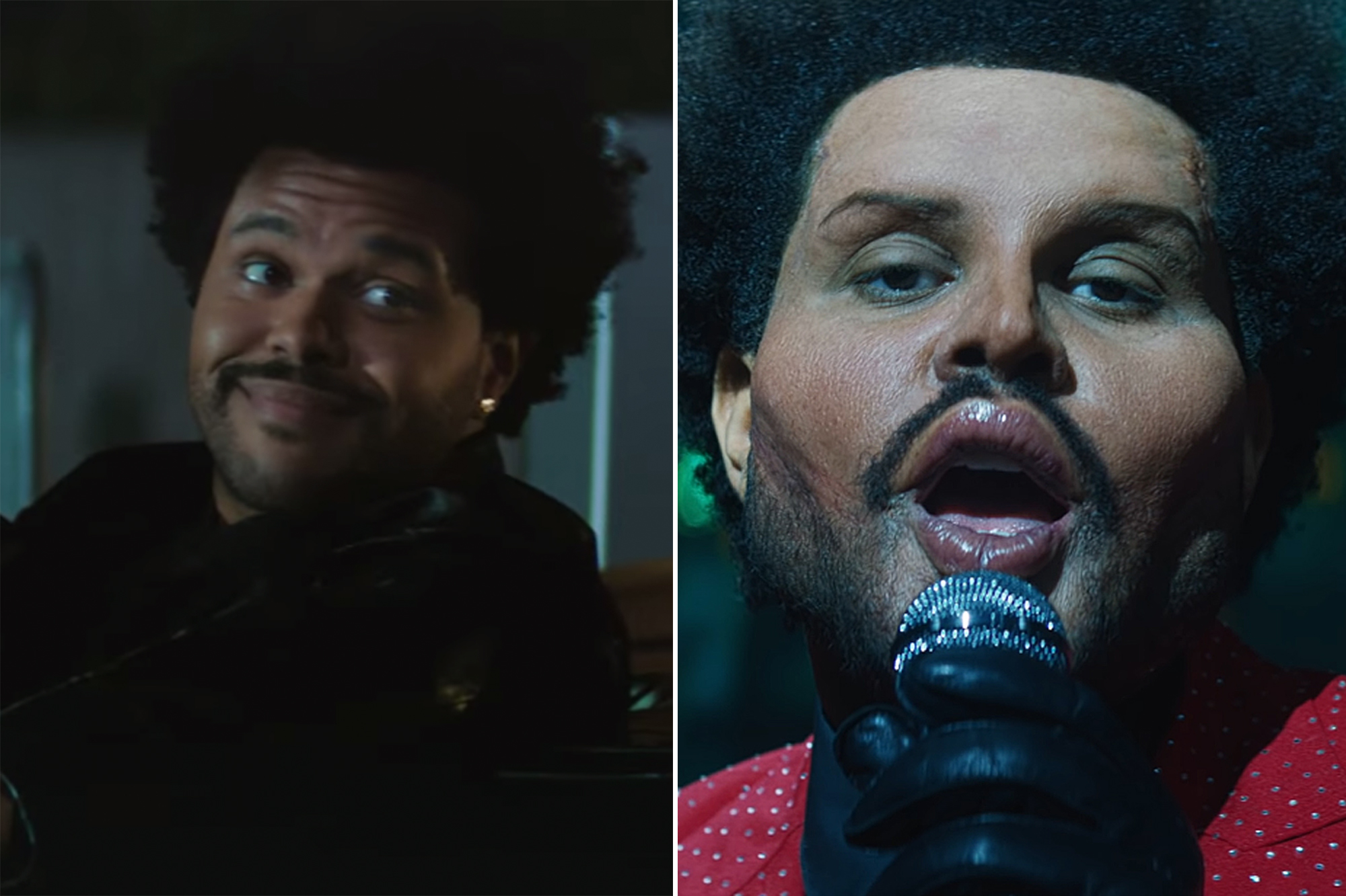 The Weeknd’s Face